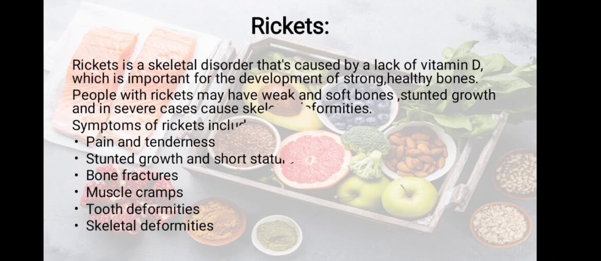 Fat soluble vitamins detailed lecture