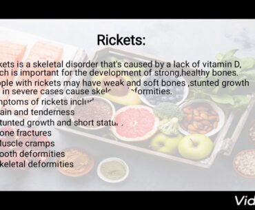 Fat soluble vitamins detailed lecture
