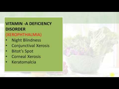Vitamin-A Deficiency Disorder - Ms B Thanuja