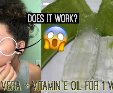 I Used Fresh Aloe Vera + Vitamin E Oil On My Face For 1 Week & This Happened