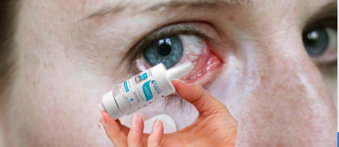 Bacterial Conjunctivitis | Bacterial Eye Infection Natural Treatment