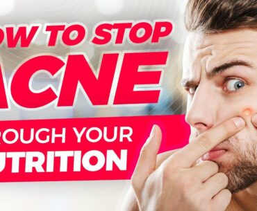 How to Stop Acne Through Nutrition