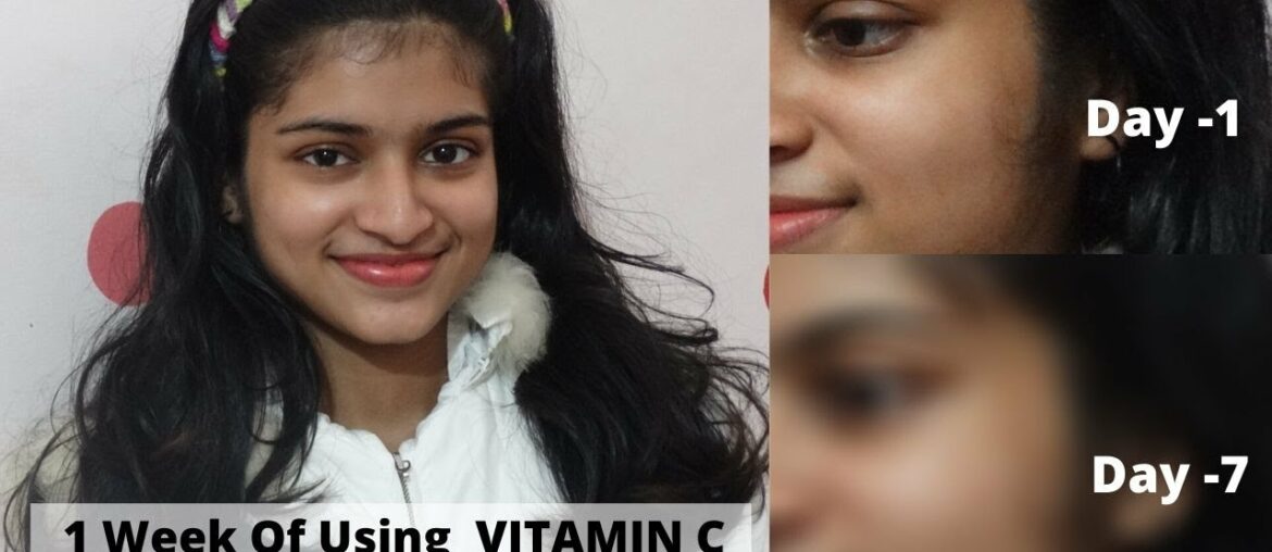 1 Week Of Using ' WOW SKIN SCIENCE VITAMIN C SERUM ' - Review And Experience In Malayalam !!