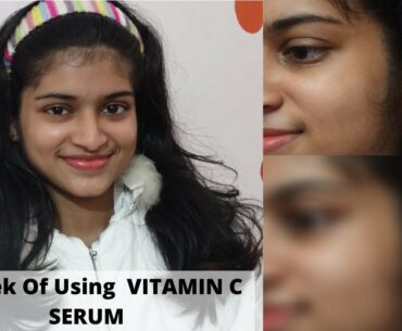 1 Week Of Using ' WOW SKIN SCIENCE VITAMIN C SERUM ' - Review And Experience In Malayalam !!