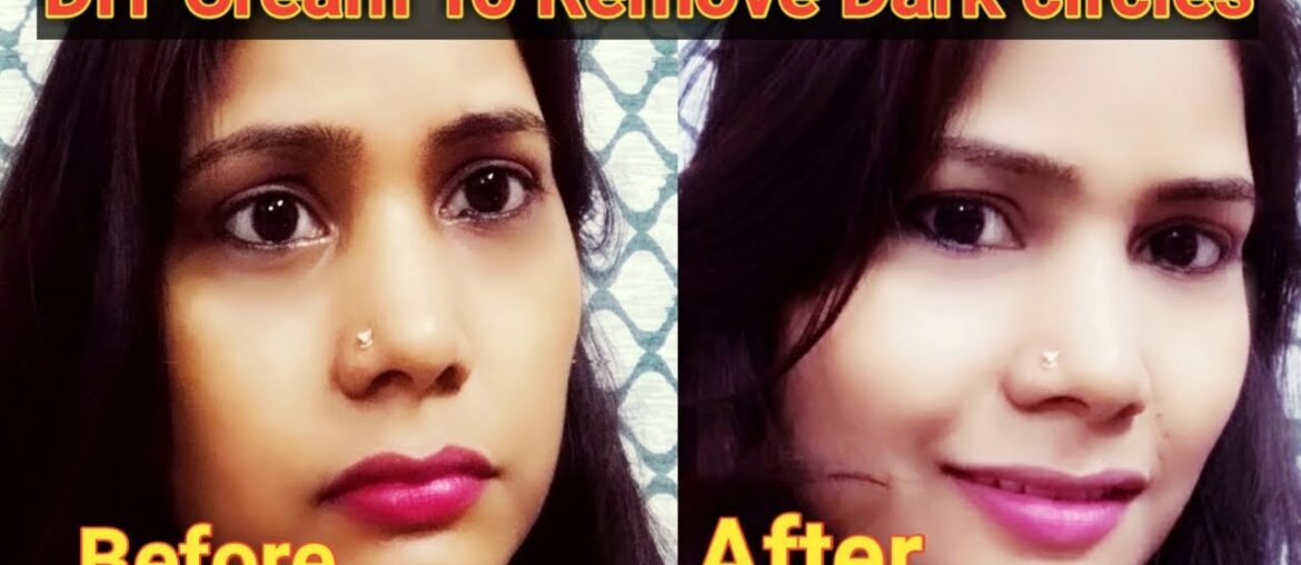 How To Remove Dark Circle/DIY Cream For Remove Dark Circle/Vitamin E/Alovera/potato.