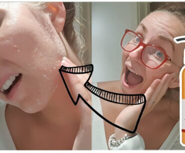 DOES IT REALLY WORK? The Body Shop Vitamin C Liquid Peel Review & Demo | Removes dead skin instantly