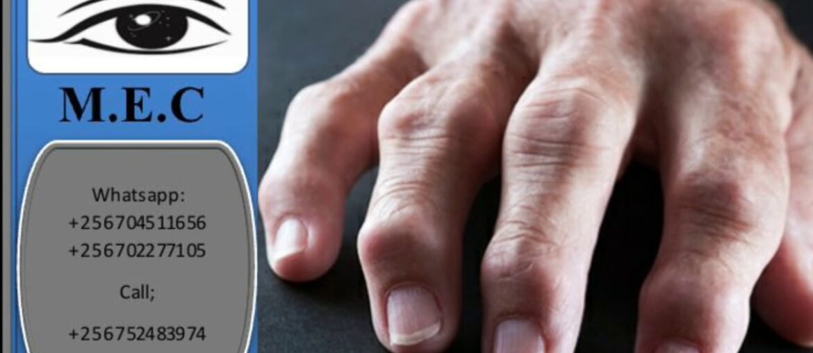 Healthy Wellness :Incredible Health Benefits Of Green Beans To Our Body :By Mind's Eyes Company