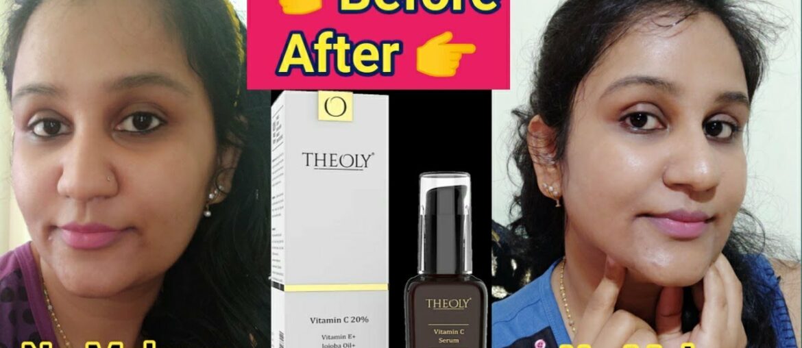 Theoly Vitamin C Facial Serum  | Skin Brightening Anti Aging Serum, Best for Pigmentation N scars
