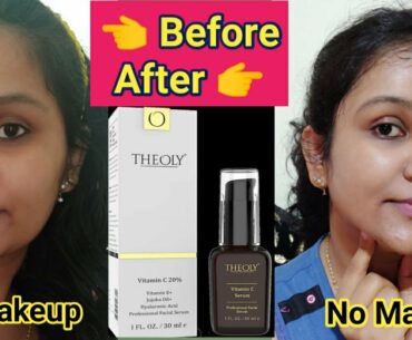 Theoly Vitamin C Facial Serum  | Skin Brightening Anti Aging Serum, Best for Pigmentation N scars