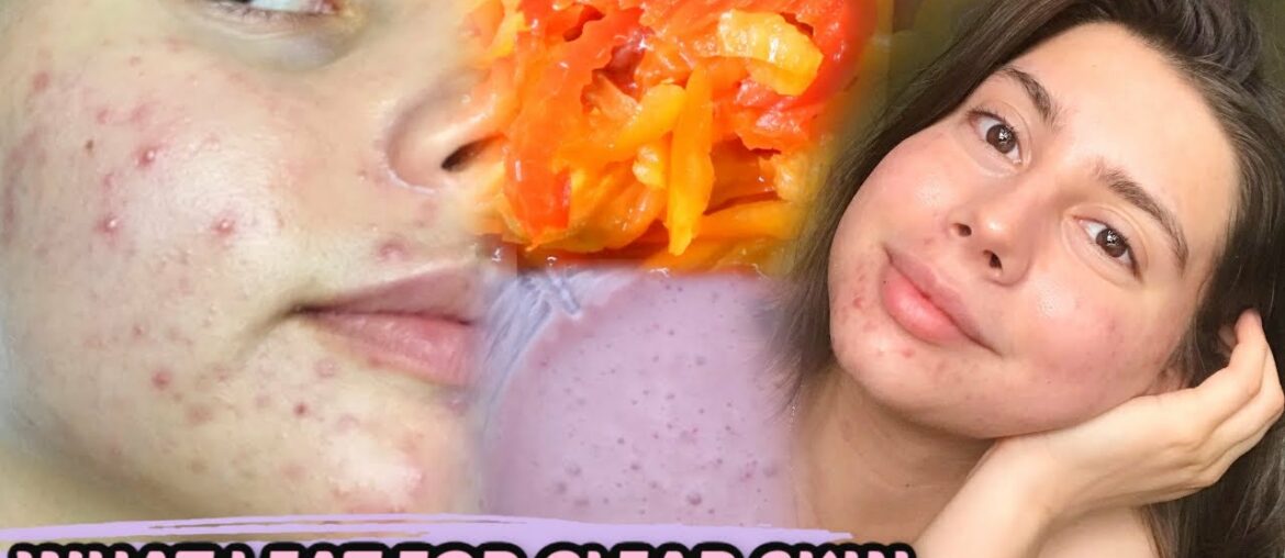 WHAT I EAT IN A DAY TO CLEAR MY ACNE, OPTIMAL GUT HEALTH || SUPPLEMENTS, DIET, EVERYTHING!!
