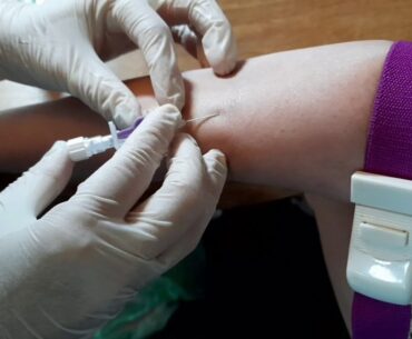 Enhanced Human Placenta Drip