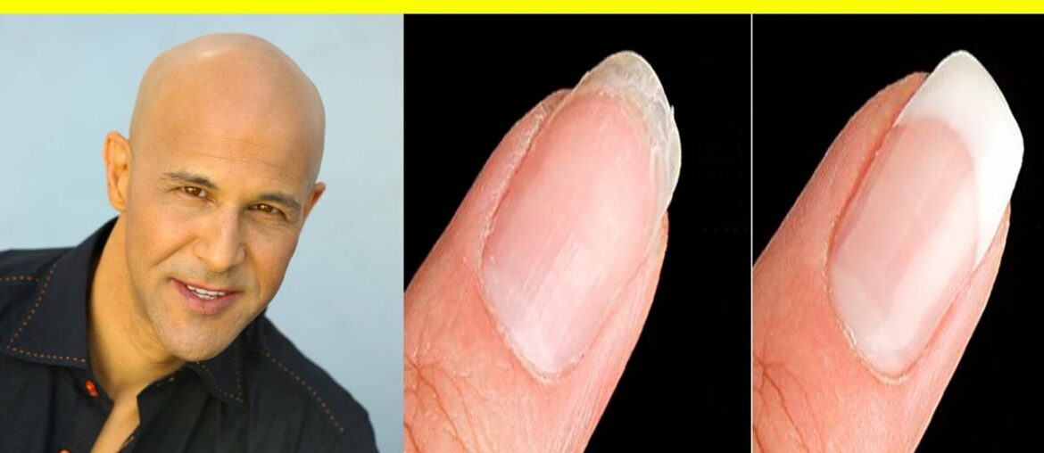 Top 10 Vitamins For Strong Healthy Nails - Dr Alan Mandell, DC