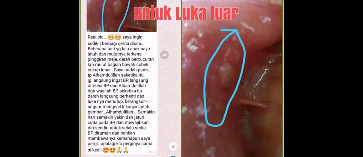 obat diabetes yang bagus WA;085772964720