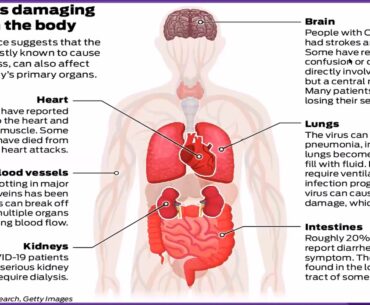 " COVID-19: Pathogenesis, Immune Response & Role of Antioxidants" by Dr  Rinku Baishya (CSIR-NEIST)