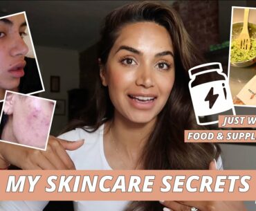 HOW I HEALED MY SKIN WITH FOOD AND SUPPLEMENTS // MY SKINCARE JOURNEY PART 3