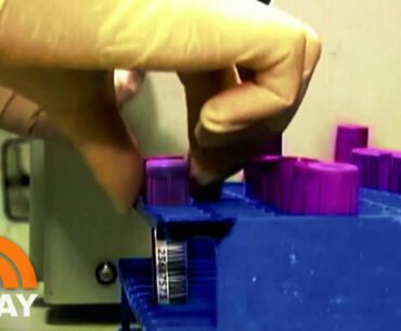 Your Blood Type Could Affect Your Coronavirus Risk, New Research Says | TODAY