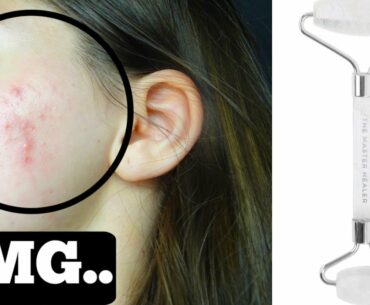 I TESTED A JADE ROLLER FOR 3 WEEKS.. THIS IS WHAT HAPPENED TO MY SKIN.
