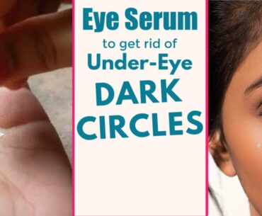Vitamin E Under Eye Treatment To Get Rid Of Dark Circles