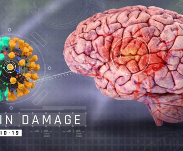 Coronavirus can damage the brain