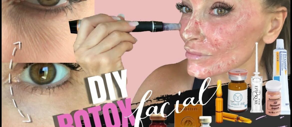 HOW TO GET RID OF DARK CIRCLES UNDER THE EYES #undereyewrinkles