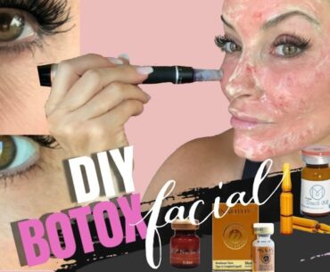 HOW TO GET RID OF DARK CIRCLES UNDER THE EYES #undereyewrinkles