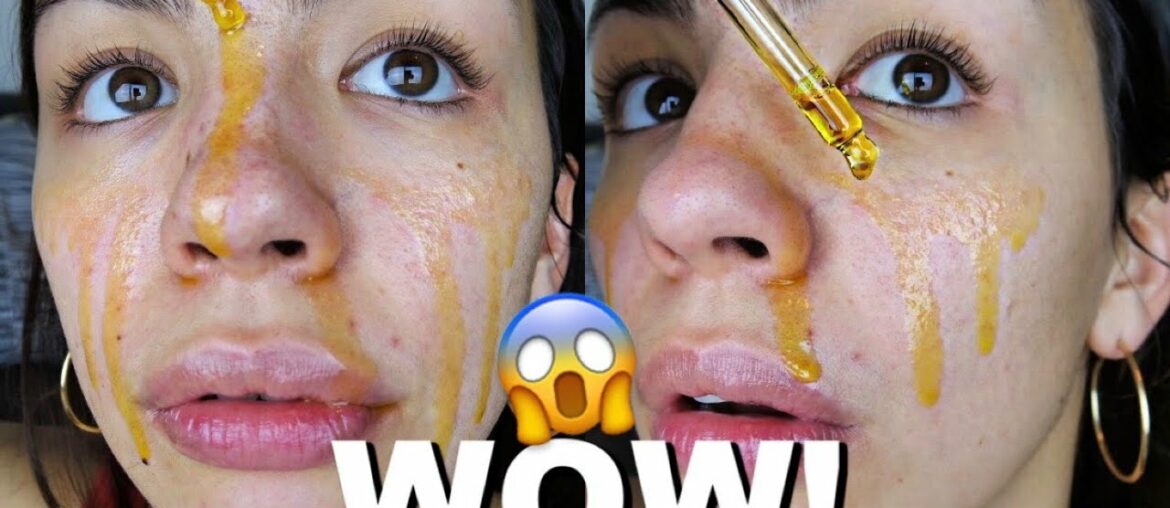 I Used ROSEHIP OIL On My Skin Everyday For One Week