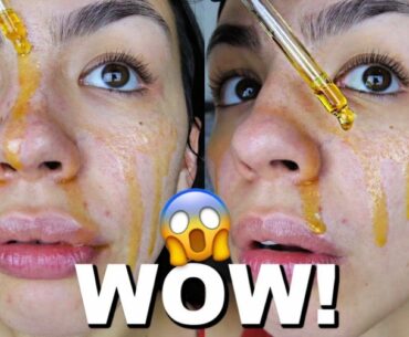 I Used ROSEHIP OIL On My Skin Everyday For One Week