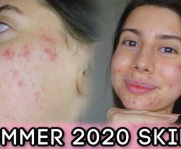 MY SUMMER SKINCARE ROUTINE 2020 || Remove dark spots, sensitive skin friendly, nourish and heal!!