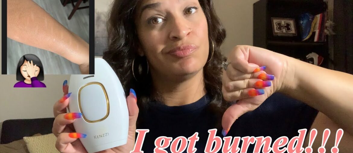 My Kenzzi burned my arms | my scars | Vitamin E oil | I got burned | Kenzzi review | Kenzzi update