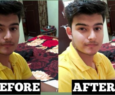 Biotrex Papaya Skin Whitening Soap|cheapest skin whitening soap| removes acne scars