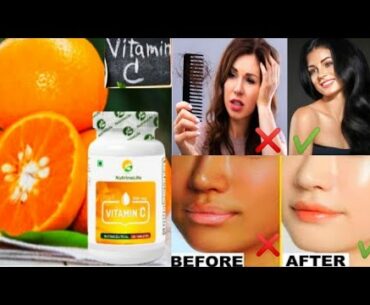 Nutrinelife Vitamin C Supplement Tablets | Benefits of Vitamin C | Nutrinelife vitamin c |#vitaminc