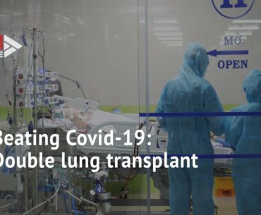 112 days on life support: A Covid-19 patient is finally recovering after double lung transplant