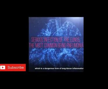 #Covid 19 #symptoms #improve immunity