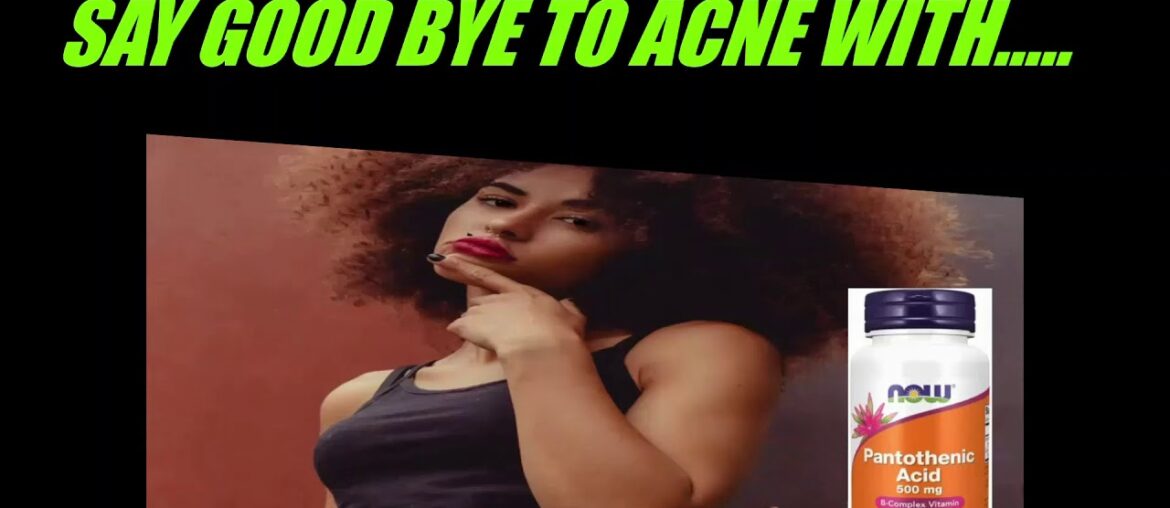 THE ACNE CURE IS.....MUST WATCH!!!