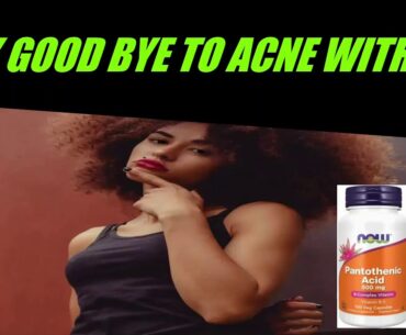 THE ACNE CURE IS.....MUST WATCH!!!
