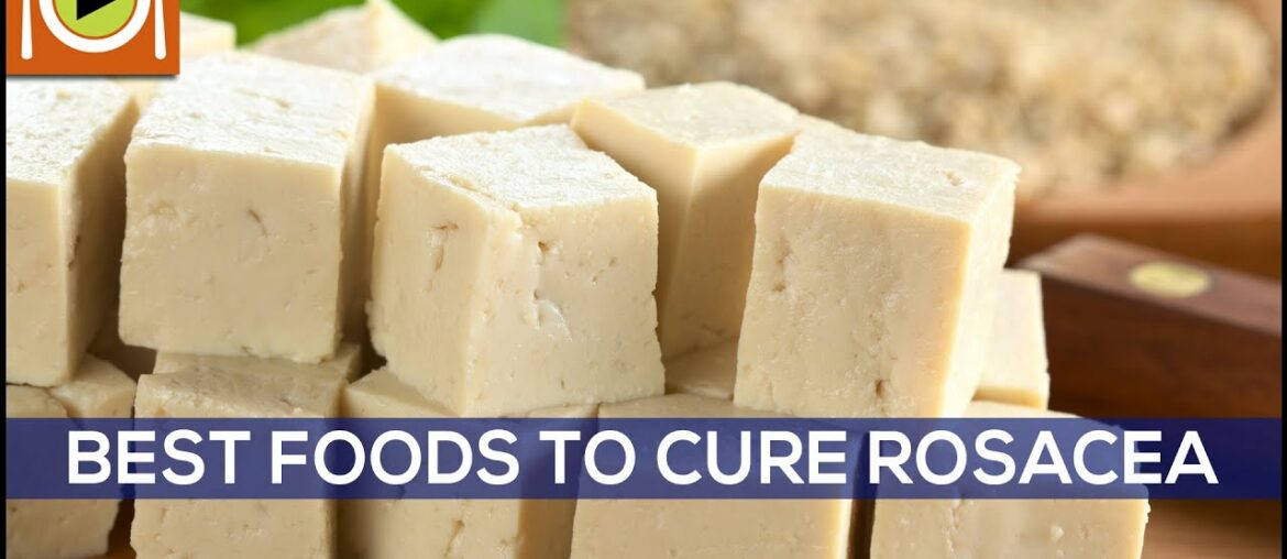 Best Foods to Cure Rosacea | Including Omega 3, Vitamin A & Vitamin C Rich Foods