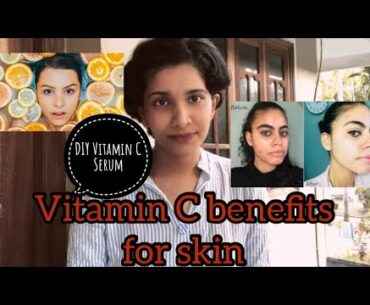 Vitamin C benefits for skin/Vitamin c foods and supplements /Vitamin C serum /DIY vitamin c serum