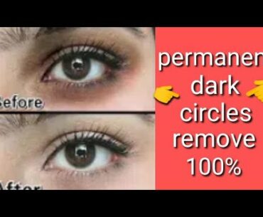 Dark circles remove in 3 days|| vitamin E-capsule (100%)working
