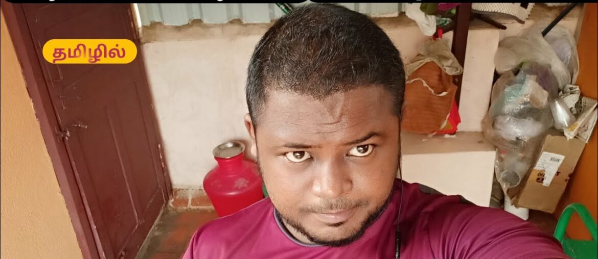 hair transplant result day 114 to day 122 / hair transplant Tamil / sarvan Tamil