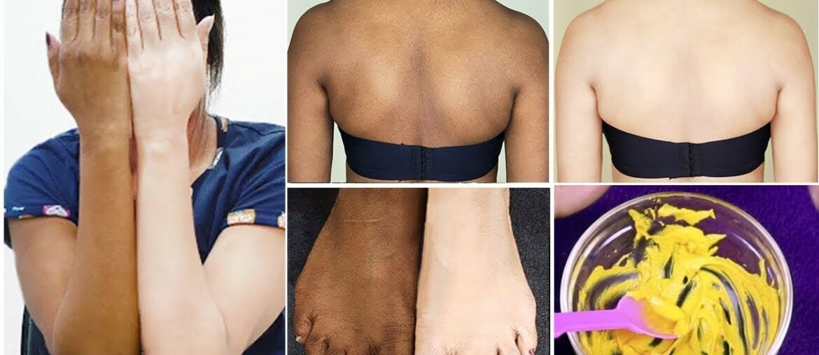 OMG ! 1 Day Full Body Whitening Challenge || simple beauty tips