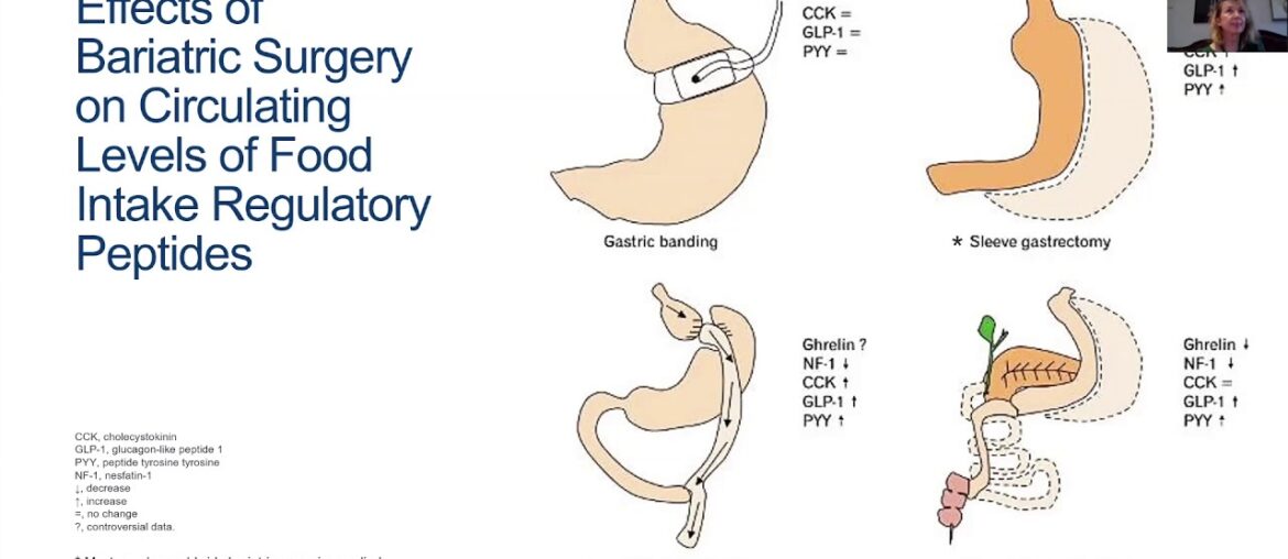 Obesity, immunity, and COVID 19