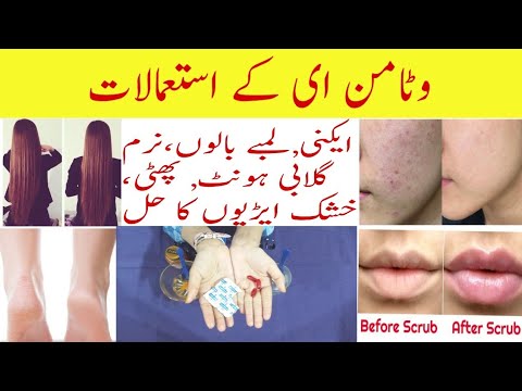 Top 4 Uses of Vitamin E Capsules for Face and Hair Care | Beauty Care Tips