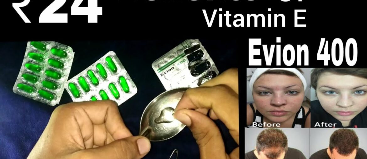 Evion 400 Vitamin E Capsule Benefits | How to Uses | Evion 400 for Skin & Hair Full Review In Hindi