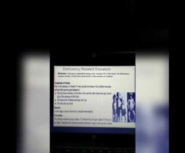 Chapter 13 ' Food & Nutrition '(EV) (PART-6)