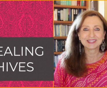 Top Natural Remedies for Hives - Mid-July, 2020 - Medica Nova Wellness Studio