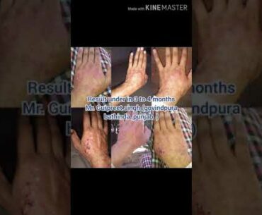 Renatus wellness , Best opportunity, best MLM,Best herbal food supplements, best mlm company