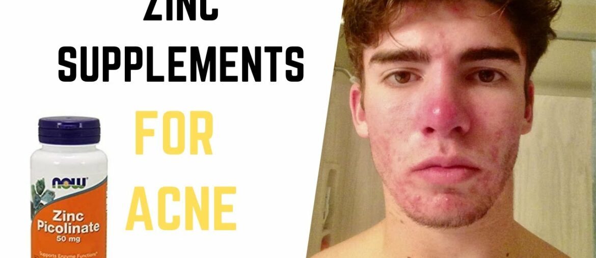 Zinc for Acne - Taking Zinc Supplements for Acne - Natural Acne Treatment