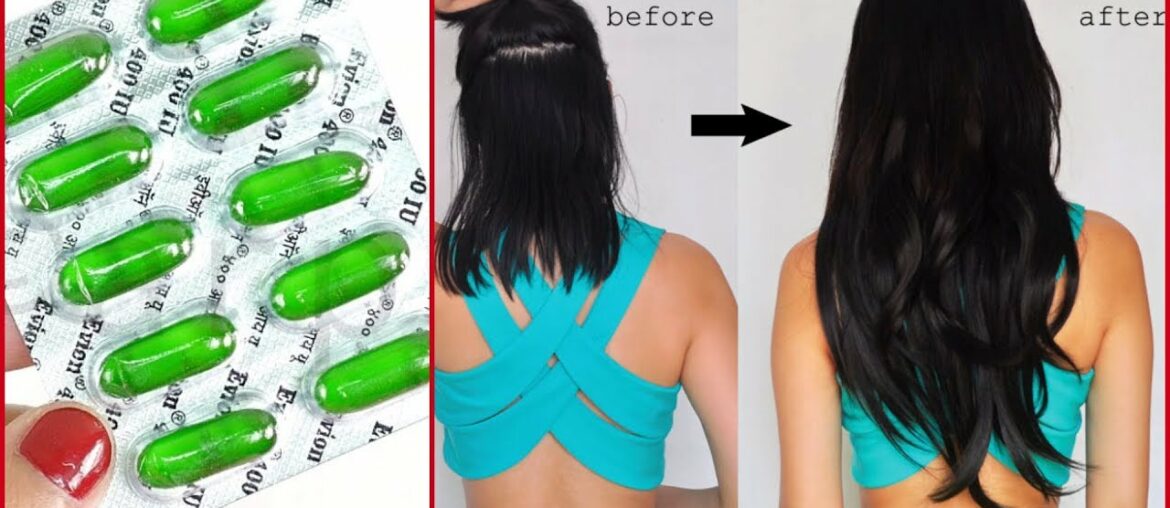 Use Vitamin E Capsule To Stop Hair Fall And Fast Hair Growth