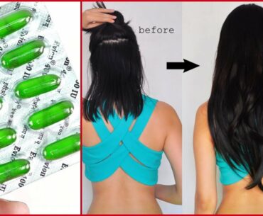 Use Vitamin E Capsule To Stop Hair Fall And Fast Hair Growth