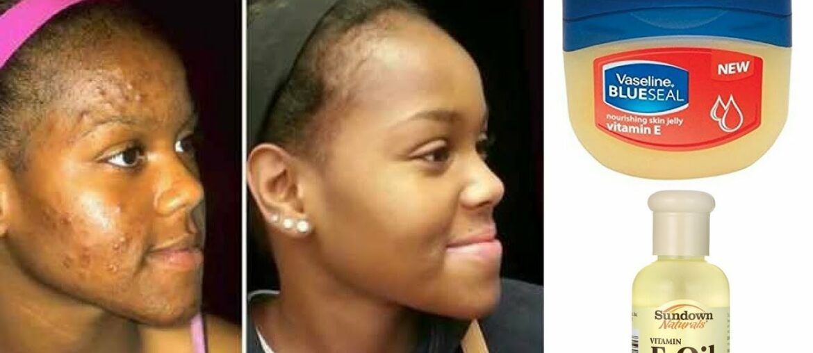 VASELINE WITH VITAMIN E OIL WILL CHANGE YOUR SKIN OVERNIGHT
